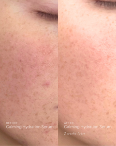Brightening + Calming Routine
